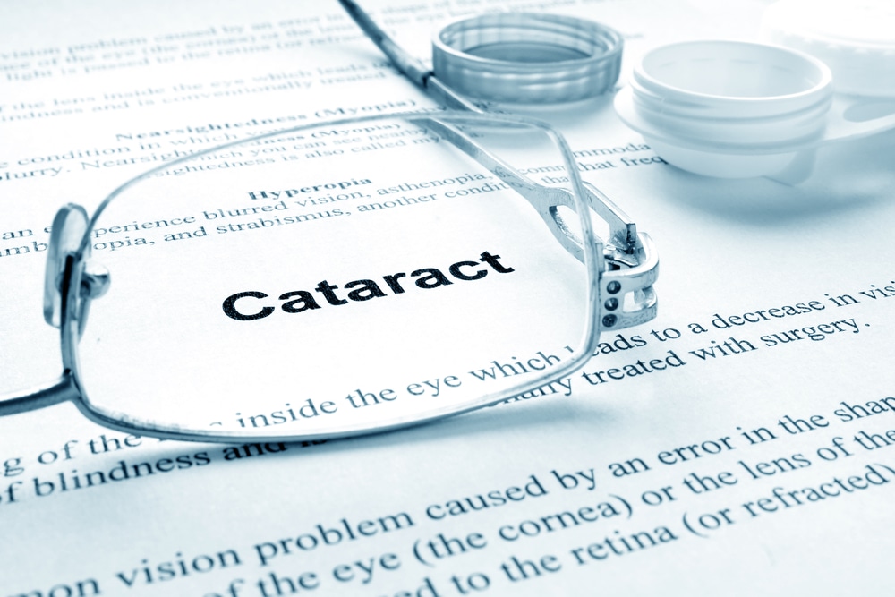 cataracteyeexam