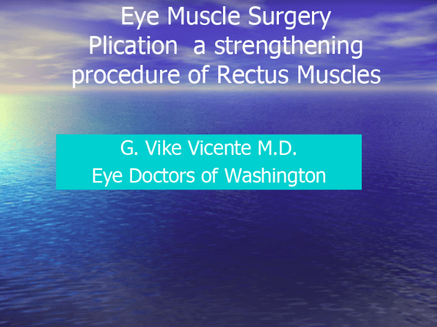 Muscle Resection of Rectus Muscles